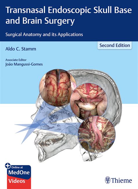 Read Rhinology And Skull Base Surgery Wardqs 