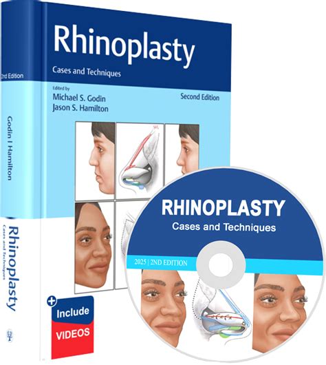 Rhinoplasty Cases And Techniques