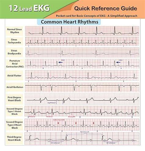 rhythms and 12 leads pocket guide english edition