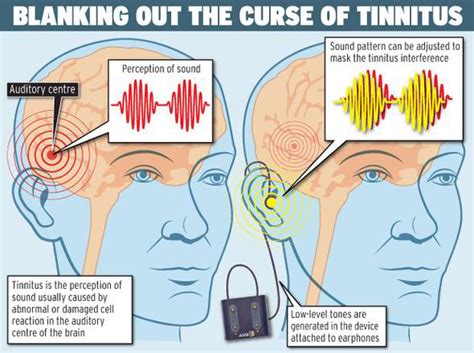 ringing noise in ear when silent