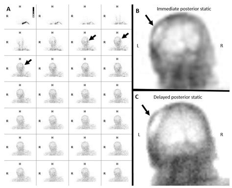 robert spaemann brain death exam