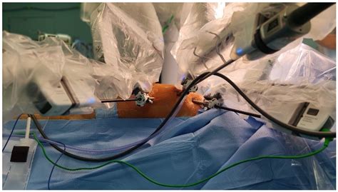 Full Download Robot Assisted Endoscopic Surgery Researchgate 