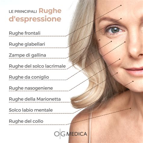 Rughe