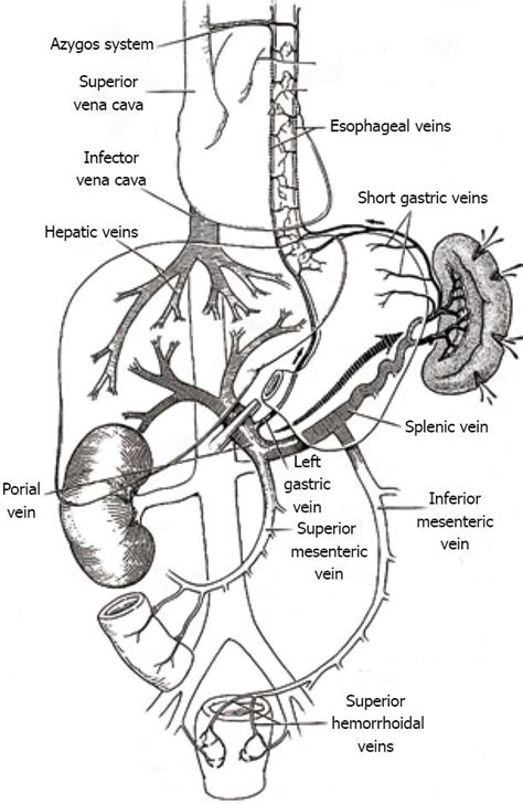 Ruptured Liver Pringle