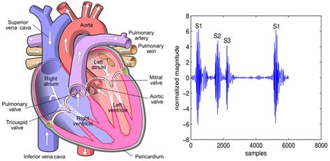 S3 Heart Sound