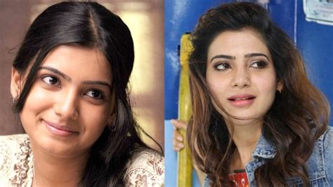 Samantha Plastic Surgery