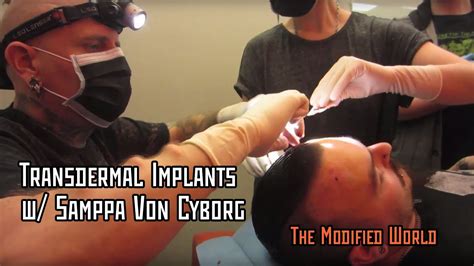 samppa von cyborg implants