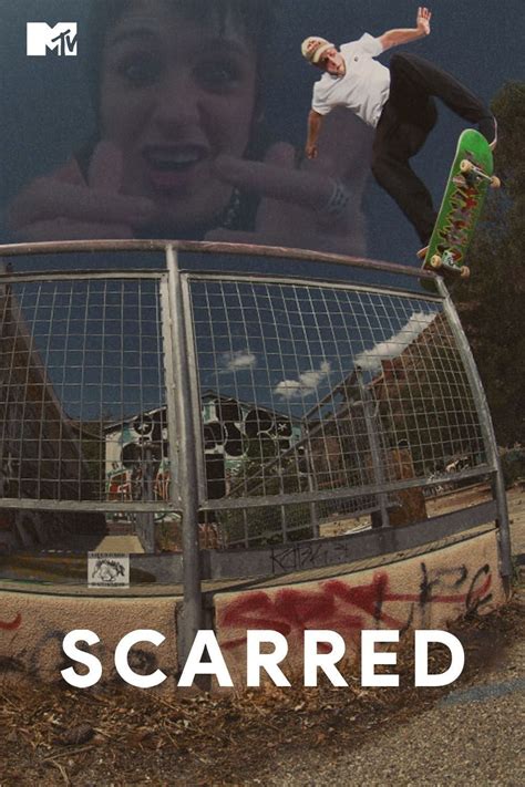 Scarred Mtv