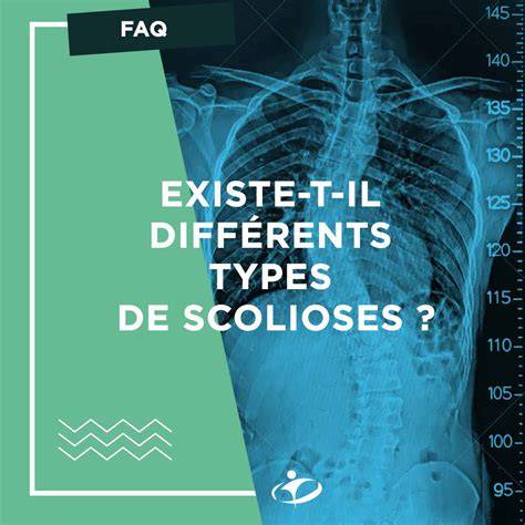 scolioses oui a a se gua c rit sans corset