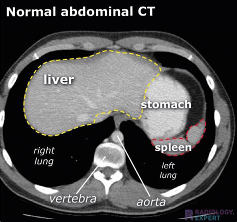 Search Pattern For Abdominal Ct