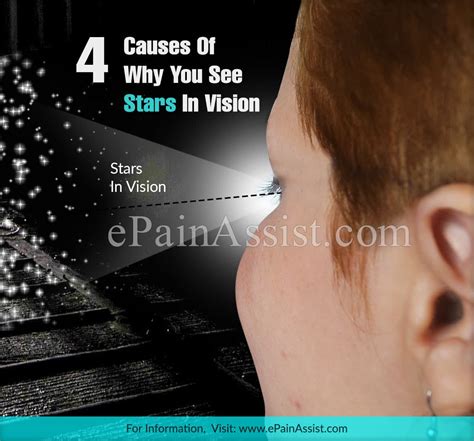 seeing stars in vision when turning head