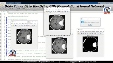 Segmentation For Brain Tumor Matlab Code