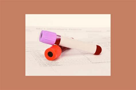 segmenten bloedonderzoek