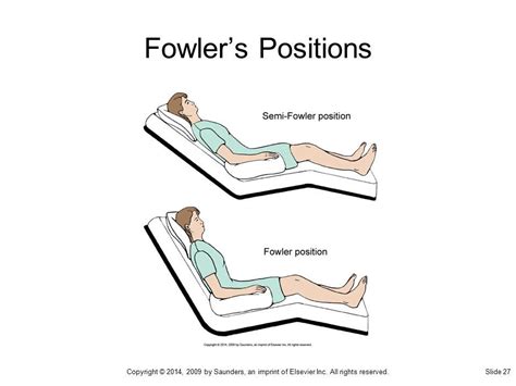 Semi Fowlers Position