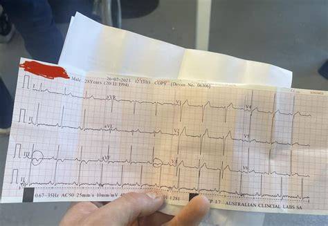 send nudes ecg
