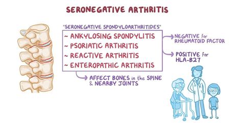 seronegative arthritis - General Practice notebook