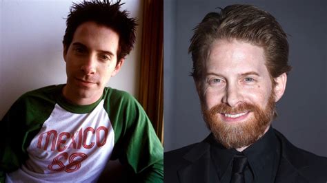 Seth Green Plastic Surgery