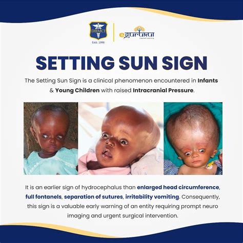 Setting Sun Sign