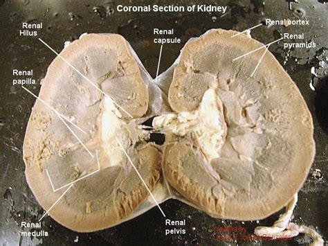 Sheep Kidney Labeled