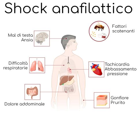 shock anafilattico api