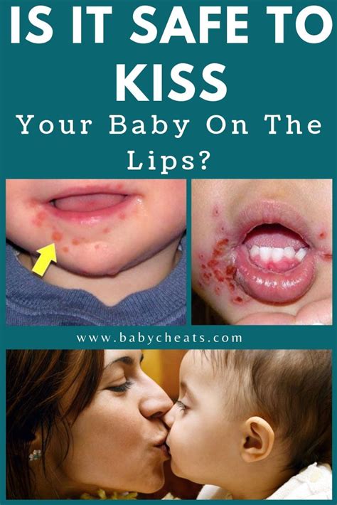 should you kiss a baby on the lips