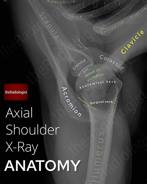 Shoulder Axial View
