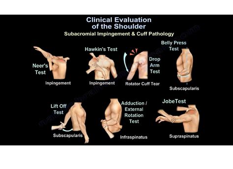 Shoulder Special Testing