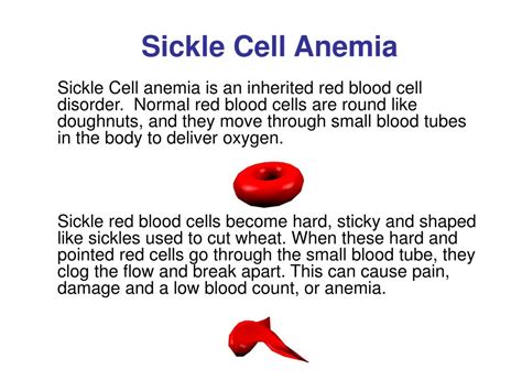 Sickle Cell Anemia Ppt