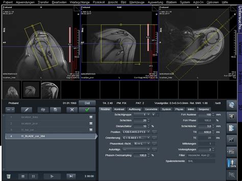 Siemens Mri Protocols