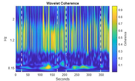 Signal Analysis Wavelet Transform Matlab Source Code