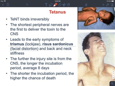 signs and symptoms Flashcards Quizlet