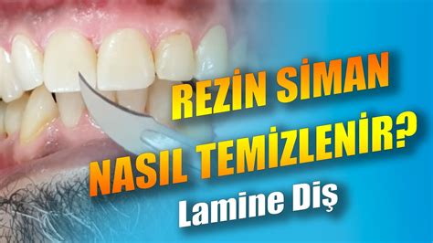 siman Nedir Ne Demek.
