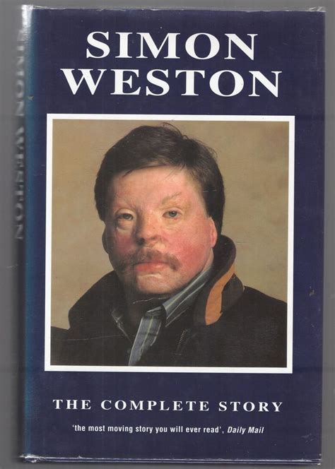 simon weston biography