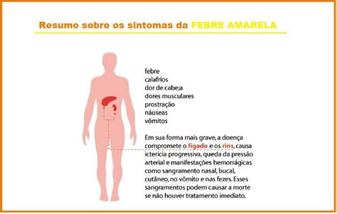 Sinal De Faget