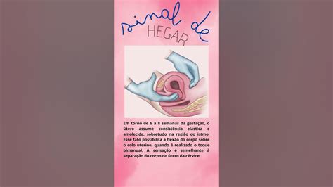 Sinal De Hegar