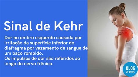 Sinal De Kehr