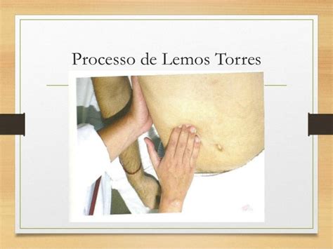 Sinal De Lemos Torres
