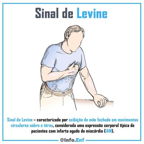 Sinal De Levine