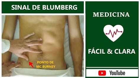 Sinal De Mcburney