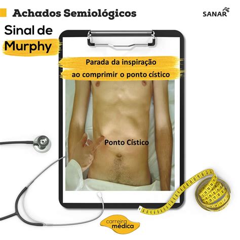 Sinal De Murphy Positivo