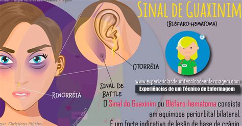 Sinal Do Guaxinim