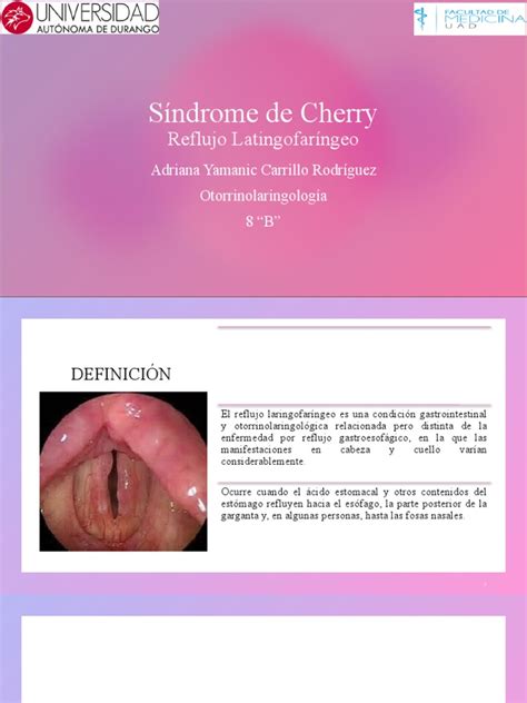 Sindrome De Cherry