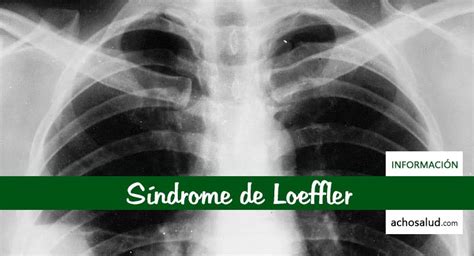 Sindrome De Loeffler