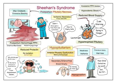 Sindrome De Sheehan