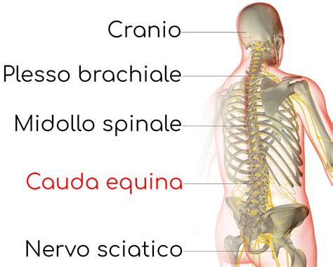 Sindrome Della Cauda Equina