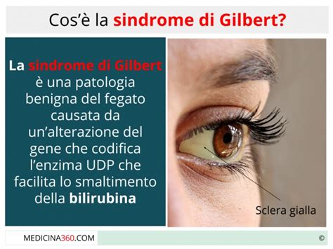 Sindrome Di Gilbert Invalidità