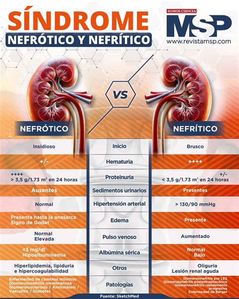 Sindrome Nefritico