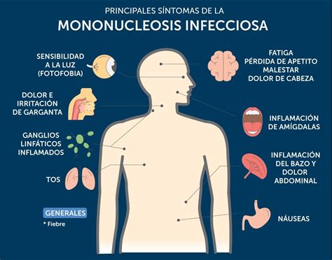 sintomas de mononucleose infecciosa