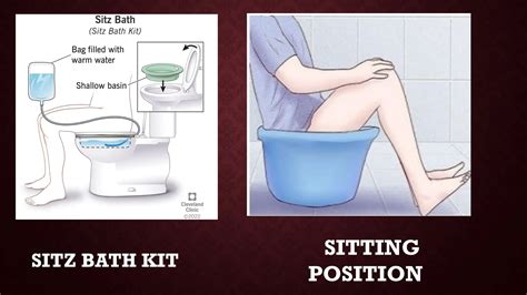 Sitz Bath Procedure