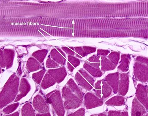Skeletal Muscle Tissue Histology Kenhub Skeletal Muscle Anatomy Worksheet - Skeletal Muscle Anatomy Worksheet